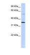 Ankyrin Repeat Domain 9 antibody, NBP1-56900, Novus Biologicals, Western Blot image 