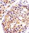 Dynein Cytoplasmic 1 Heavy Chain 1 antibody, PA5-49451, Invitrogen Antibodies, Immunohistochemistry frozen image 