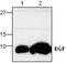 Epidermal Growth Factor antibody, GTX59830, GeneTex, Western Blot image 