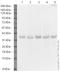 Voltage Dependent Anion Channel 1 antibody, ab15895, Abcam, Western Blot image 