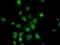 Annexin A3 antibody, MA5-25342, Invitrogen Antibodies, Immunocytochemistry image 