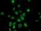 Annexin A3 antibody, MA5-25342, Invitrogen Antibodies, Immunocytochemistry image 