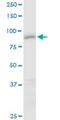 Centrosomal Protein 85 antibody, H00064793-B01P, Novus Biologicals, Western Blot image 