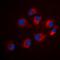 DNA Fragmentation Factor Subunit Alpha antibody, orb74341, Biorbyt, Immunofluorescence image 