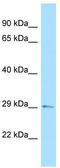 TGFB Induced Factor Homeobox 2 antibody, TA345340, Origene, Western Blot image 