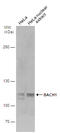 BTB Domain And CNC Homolog 1 antibody, GTX110292, GeneTex, Western Blot image 
