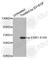 Estrogen Receptor 1 antibody, AP0145, ABclonal Technology, Western Blot image 