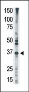 Melanoma-associated antigen 2 antibody, AP13129PU-N, Origene, Western Blot image 