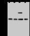 Exosome Component 2 antibody, 203085-T44, Sino Biological, Western Blot image 