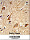 Polypeptide N-Acetylgalactosaminyltransferase 2 antibody, 63-901, ProSci, Immunohistochemistry paraffin image 
