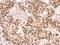 Lamin B2 antibody, GTX109894, GeneTex, Immunohistochemistry paraffin image 