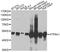 ATP Synthase F1 Subunit Alpha antibody, A5884, ABclonal Technology, Western Blot image 