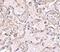 Glutathione S-transferase P 1 antibody, NBP1-76857, Novus Biologicals, Immunohistochemistry paraffin image 