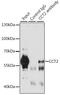 Chaperonin Containing TCP1 Subunit 2 antibody, GTX33535, GeneTex, Immunoprecipitation image 