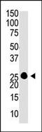 Guanylate Cyclase Activator 1A antibody, PA5-11658, Invitrogen Antibodies, Western Blot image 