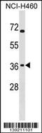 ST6 N-Acetylgalactosaminide Alpha-2,6-Sialyltransferase 4 antibody, 60-240, ProSci, Western Blot image 