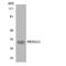 Serine Protease 33 antibody, OAAF06983, Aviva Systems Biology, Western Blot image 