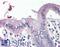 Sodium Channel Epithelial 1 Gamma Subunit antibody, LS-B3024, Lifespan Biosciences, Immunohistochemistry paraffin image 