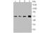 Interferon Alpha And Beta Receptor Subunit 1 antibody, NBP2-75534, Novus Biologicals, Western Blot image 