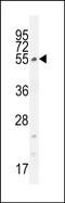 Coiled-Coil Domain Containing 61 antibody, PA5-48238, Invitrogen Antibodies, Western Blot image 