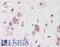 ADAP antibody, LS-B16053, Lifespan Biosciences, Immunohistochemistry paraffin image 