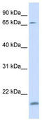 KIAA1339 antibody, TA345584, Origene, Western Blot image 