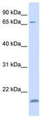 Zinc Finger Protein 398 antibody, TA345584, Origene, Western Blot image 