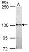 Structural maintenance of chromosomes protein 5 antibody, NBP2-20419, Novus Biologicals, Western Blot image 