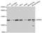 Serine And Arginine Repetitive Matrix 1 antibody, STJ27860, St John