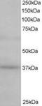 ATPase H+ Transporting Accessory Protein 2 antibody, MBS420521, MyBioSource, Western Blot image 