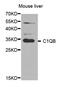 Complement C1q B Chain antibody, MBS2516926, MyBioSource, Western Blot image 