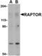 Regulatory Associated Protein Of MTOR Complex 1 antibody, LS-B3798, Lifespan Biosciences, Western Blot image 