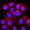 Peptidase, Mitochondrial Processing Beta Subunit antibody, A11793-1, Boster Biological Technology, Immunofluorescence image 