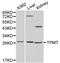 Thiopurine S-Methyltransferase antibody, LS-C192514, Lifespan Biosciences, Western Blot image 