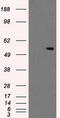 Protein Kinase, Membrane Associated Tyrosine/Threonine 1 antibody, M06247, Boster Biological Technology, Western Blot image 