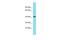 Family With Sequence Similarity 181 Member B antibody, PA5-71107, Invitrogen Antibodies, Western Blot image 