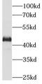 Interleukin 1 Receptor Type 2 antibody, FNab04243, FineTest, Western Blot image 