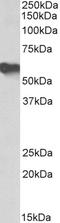 Alpha 2-HS Glycoprotein antibody, LS-C204965, Lifespan Biosciences, Western Blot image 