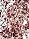 Diglyceride kinase iota antibody, 63-406, ProSci, Immunohistochemistry paraffin image 