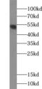 Zinc Finger Protein 140 antibody, FNab09657, FineTest, Western Blot image 