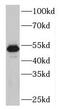 PLAG1 Zinc Finger antibody, FNab06515, FineTest, Western Blot image 