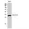 NADH:Ubiquinone Oxidoreductase Core Subunit S3 antibody, LS-C384796, Lifespan Biosciences, Western Blot image 