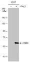 Paired Box 3 antibody, GTX114094, GeneTex, Western Blot image 