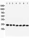 RAB9A, Member RAS Oncogene Family antibody, PA2281, Boster Biological Technology, Western Blot image 