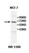 Zinc Finger Protein 404 antibody, orb78072, Biorbyt, Western Blot image 