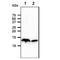 Cystatin A antibody, GTX57681, GeneTex, Western Blot image 