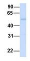 Sushi Domain Containing 4 antibody, GTX46312, GeneTex, Western Blot image 