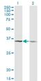 CD58 Molecule antibody, H00000965-M02, Novus Biologicals, Western Blot image 