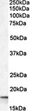 Peptidylprolyl Isomerase A antibody, orb19146, Biorbyt, Western Blot image 