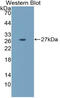 Laminin Subunit Alpha 5 antibody, MBS2012978, MyBioSource, Western Blot image 